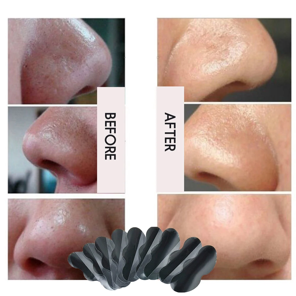 Effective Blackheads Removal Mask Nose Purifying Deep Cleaning 10pcs Black Pore Contraction T District Care Water Hydrating | Красота и