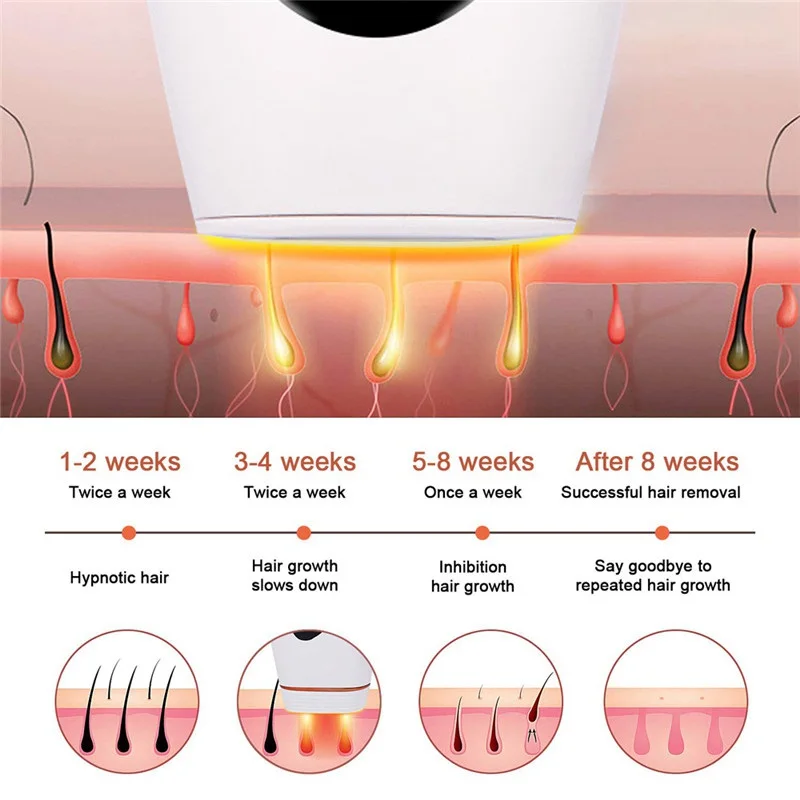 

Professional IPL epilator laser hair removal photoepilator machine face body photo permanent Pulsed light device