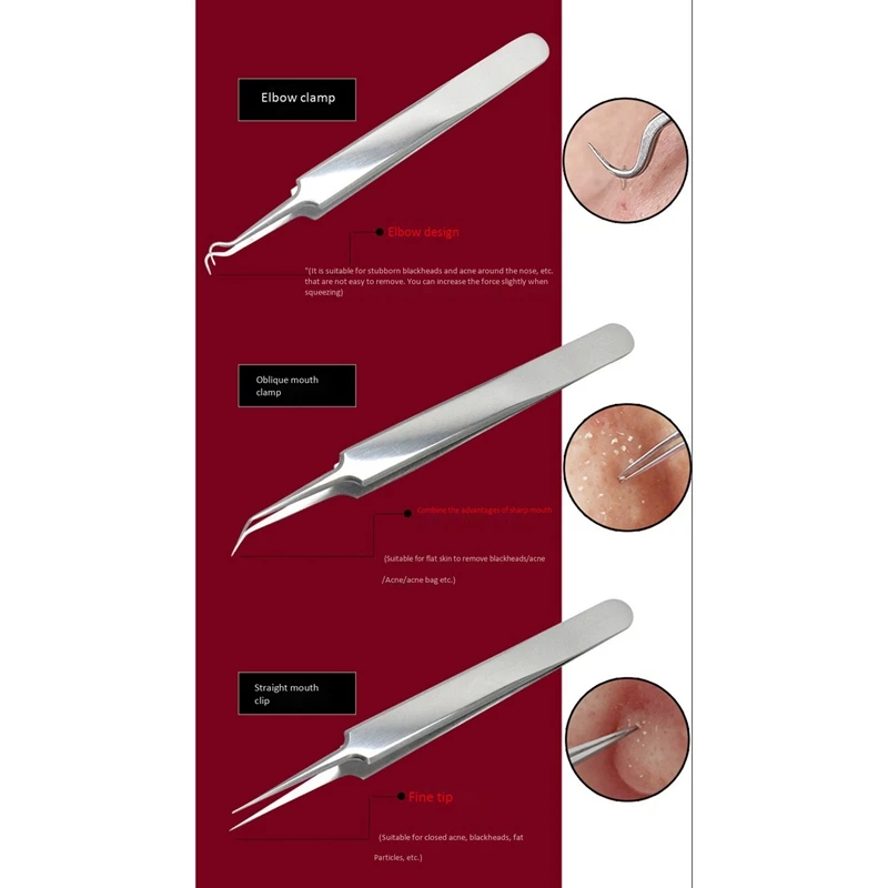 Acne Nose Blackhead Remover White Head Tool Pimple Removal Needle | Красота и здоровье