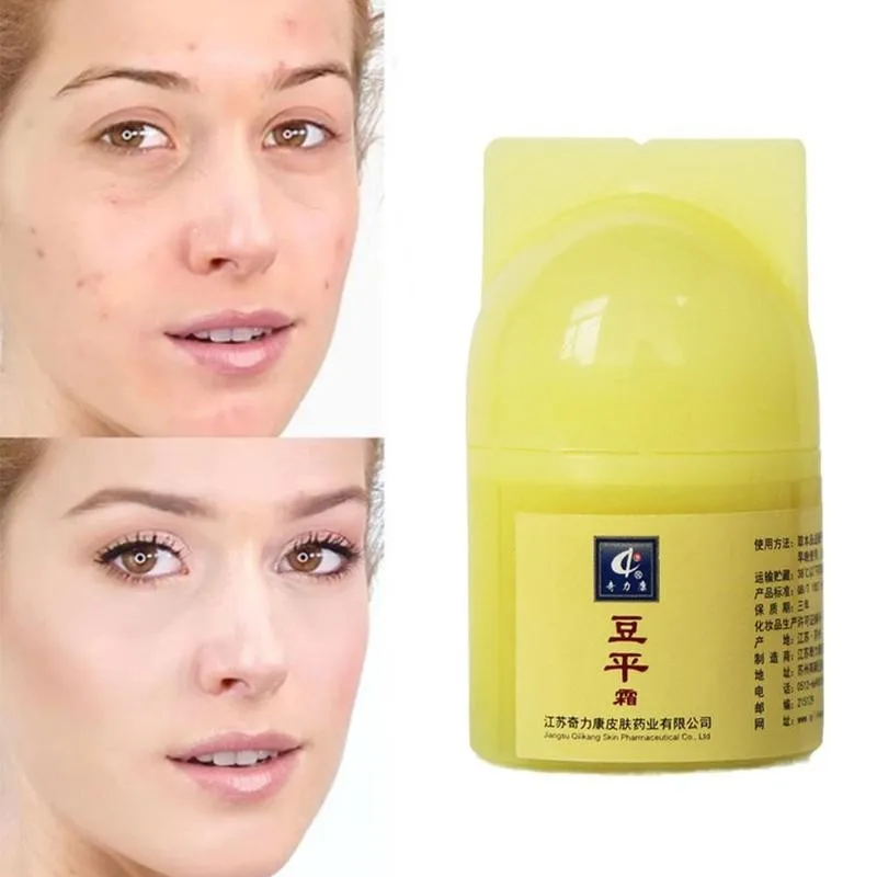 

Effective Chinese Acne Removal Cream Acne Treatment Fade Acne Spots Oil Control Shrink Pores Whitening Acne Gel Skin Care 10g