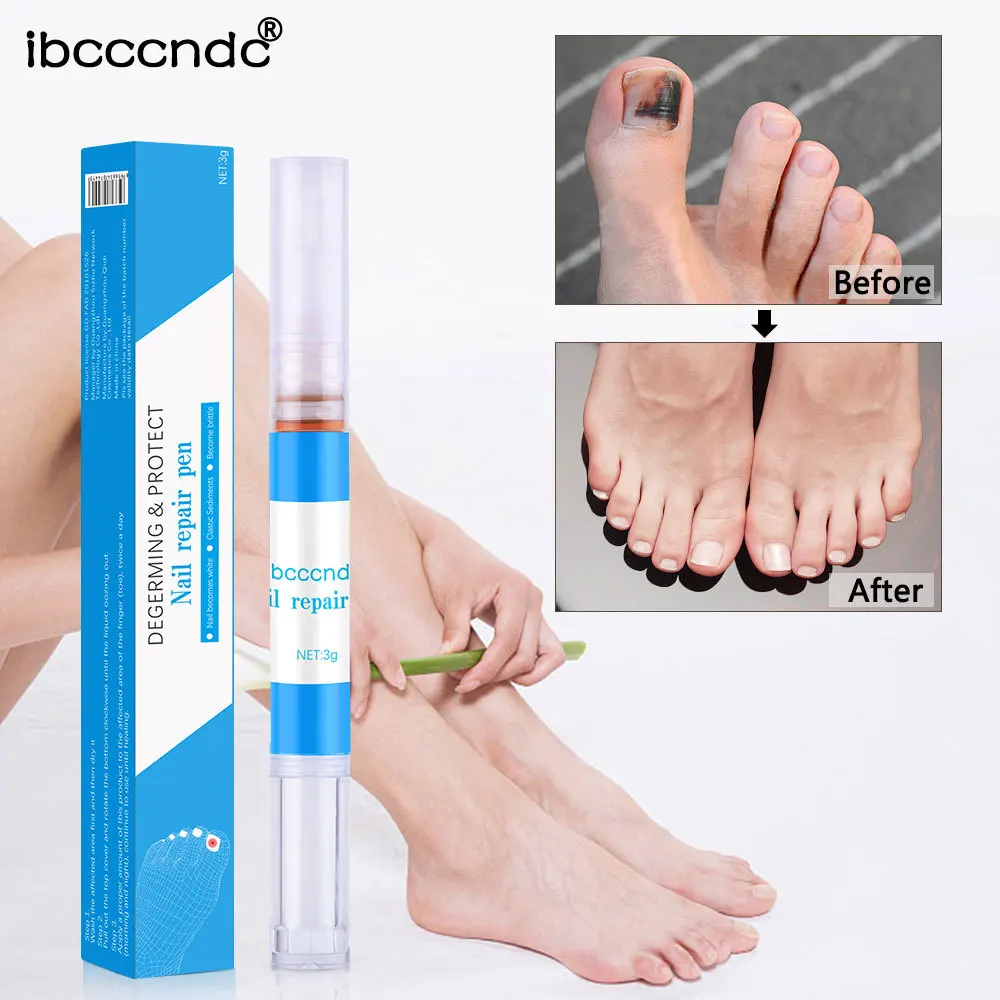 Ibcccndc Nail Care Solution Pen Go Gray Biofilm a Polish Remove Pencil | Красота и здоровье