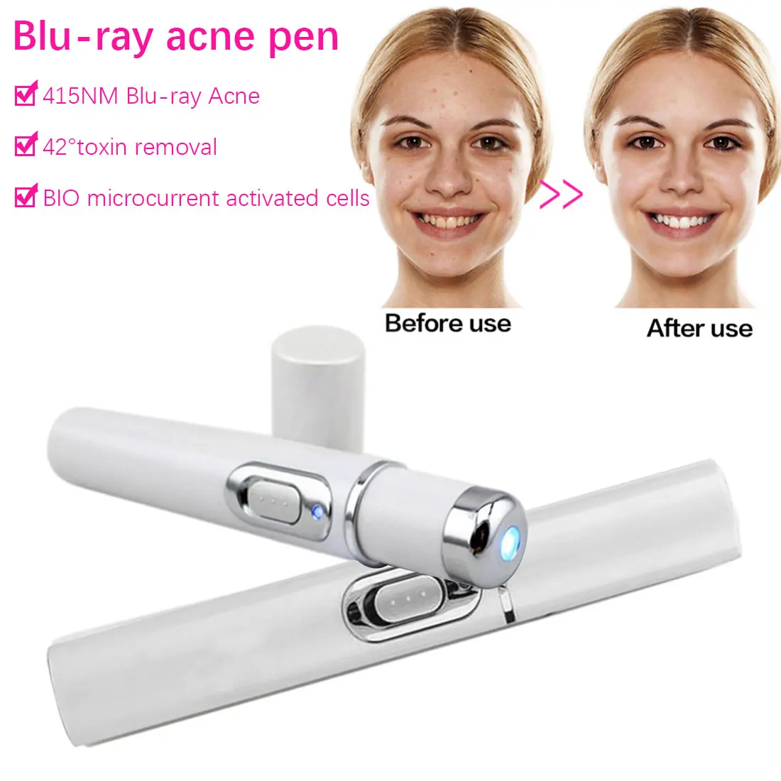 Новинка Электрический вибрирующий массажер для глаз удаления темных кругов и