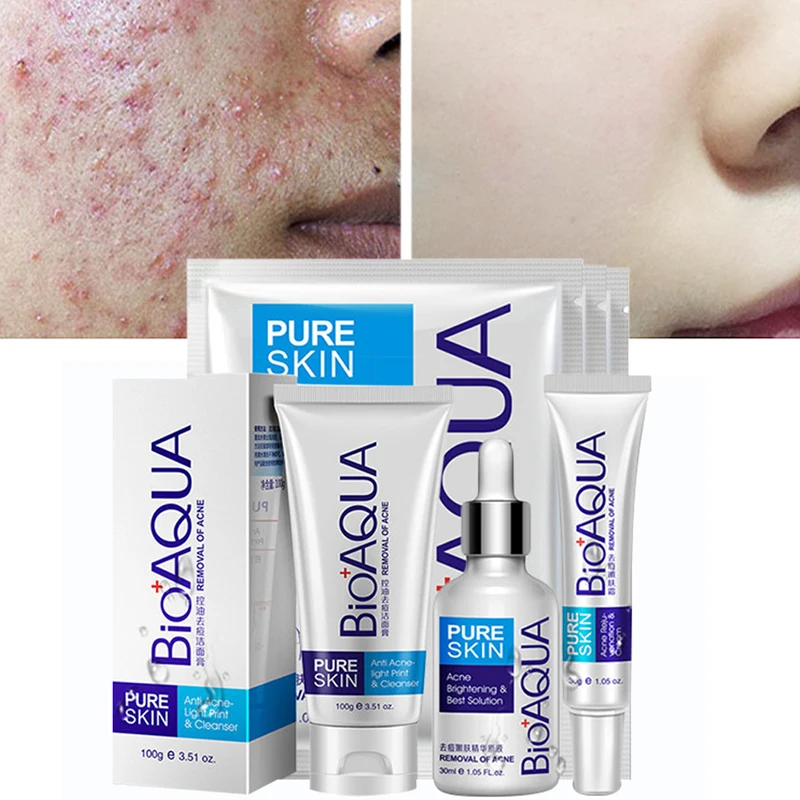 

Four-piece Facial Treatment Moisturizing Remove Acne Cleansing Nourish Oil Control Dilute Pores Anti-drying Unisex Skin Care