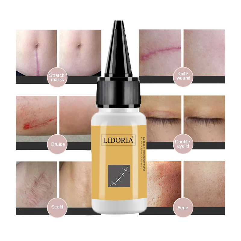 1pc 20ml Herbal Scar Mark Removal Skin Whole Body Care Cream Blemish Treatment Skin Scar Smoothing Repair Fluid Skincare TSLM1