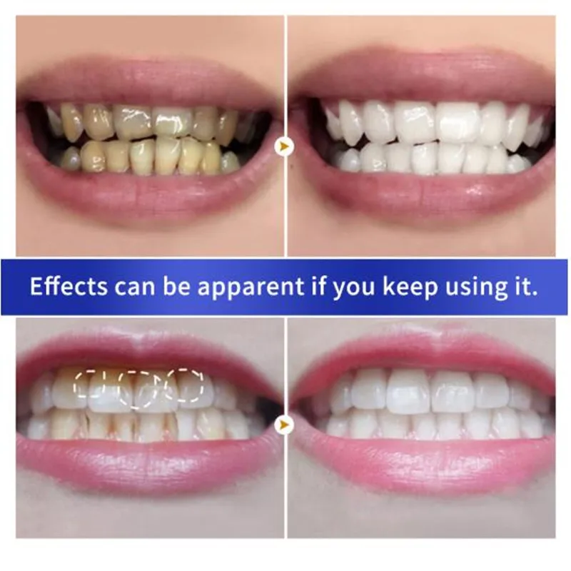 Жемчужный порошок для отбеливания зубов зубная паста отбеливание чистка гигиена