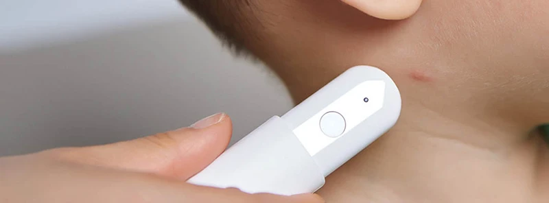 XIAOMI MIJIA MY физический москитный репеллент устраняет москитный зуд палка для детской кожи, безопасный для детей, пожилых людей защищает портативный
