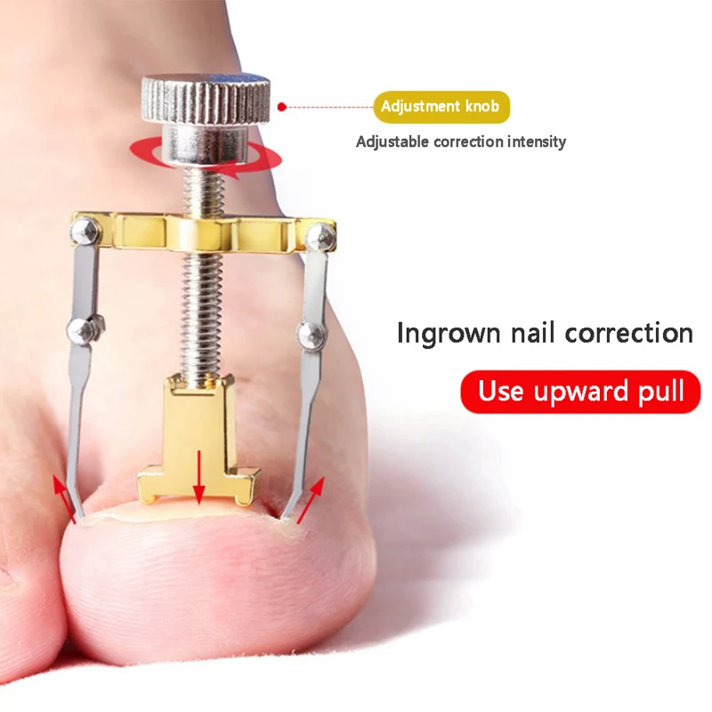 

Коррекция вросшего ногтя Педикюр Уход за ногтями выпрямление клипса корректор вросший ног искусственная коррекция ногтей
