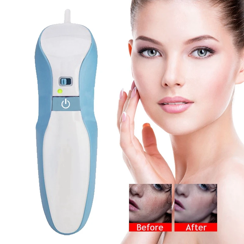 

Plasma Pen Wrinkle Plasmapen Eyelid Lift Skin lifting Tattoo Mole Removal Plasma Pen Beauty With 3 Needle Face Skin Care Machine