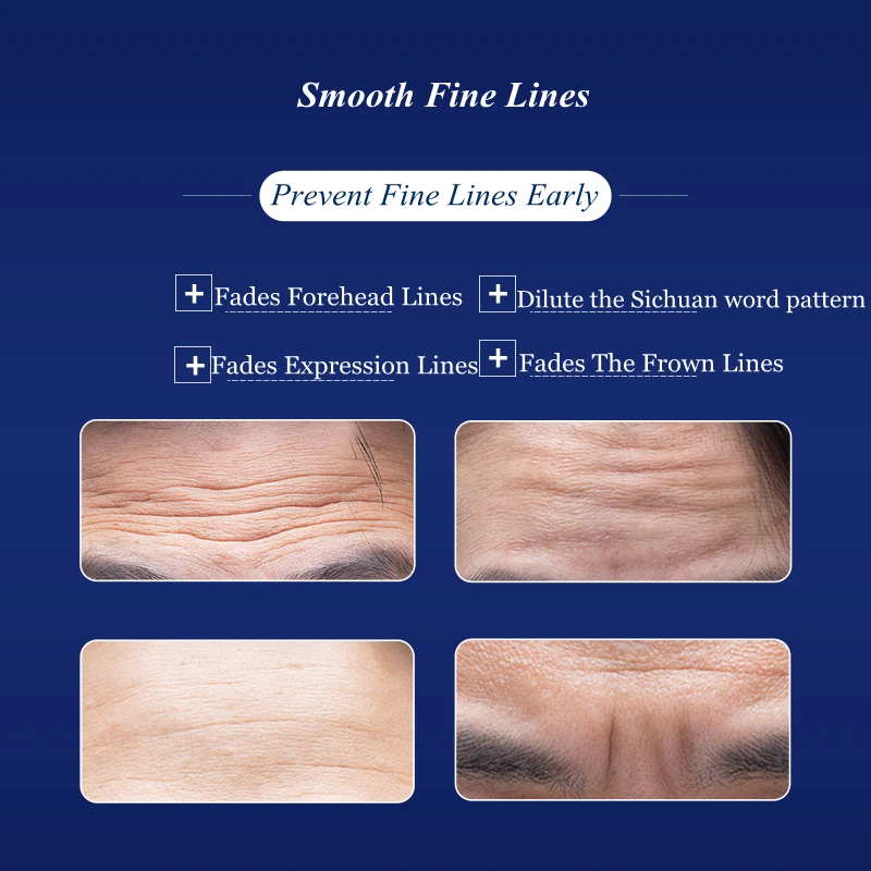 

Forehead Line Removal Anti-wrinkle Stickers Frown Lines Treatment Anti-aging Lifting Mask Moisturizng Patch-(1 box, 1box)