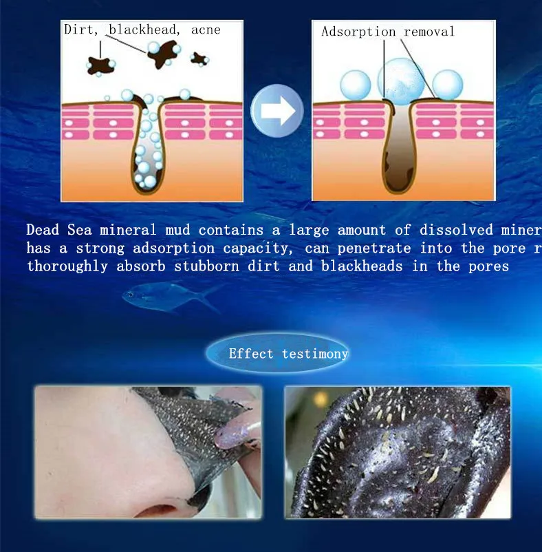 Маска для угрей уход за лицом черная маска носа очиститель пилинг очищения пор