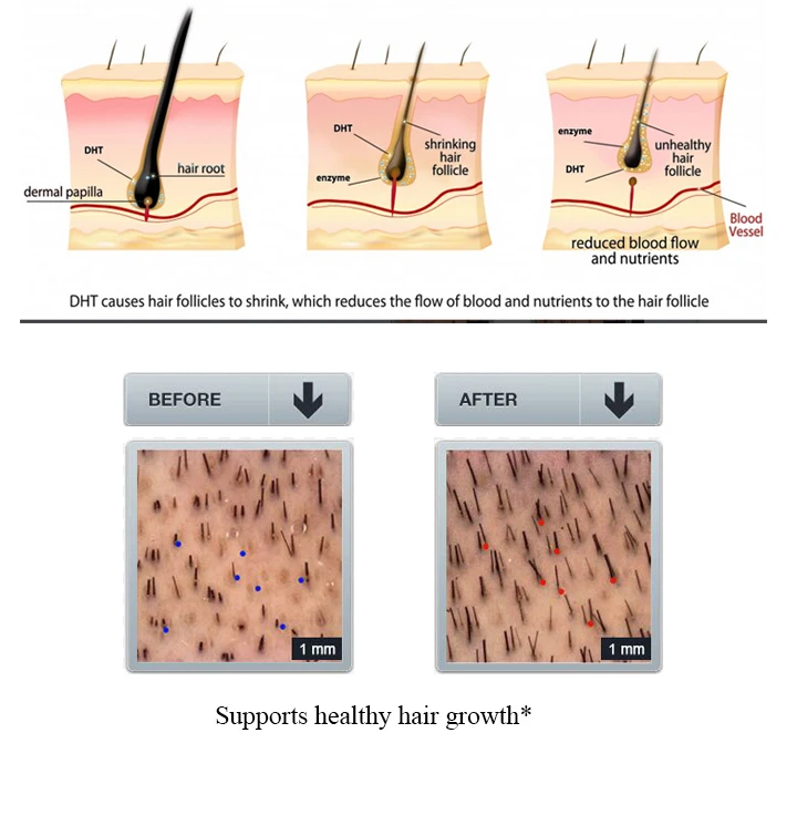 

Herbal Ginseng Hair Care Essence Treatment For Hair Loss Help Hair Regrowth Serum Repair Hair root Thicken Hair Shampoo