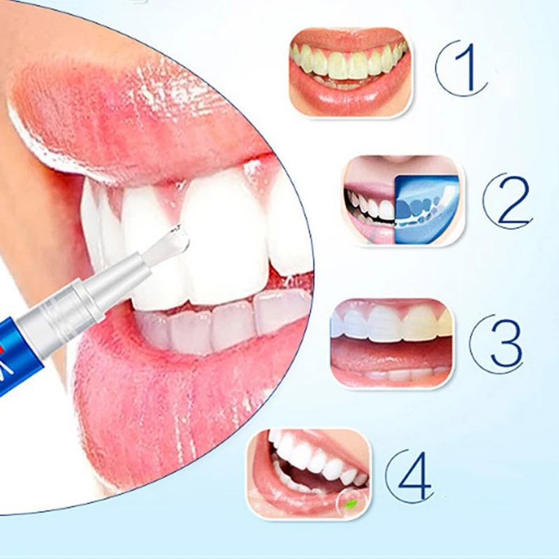 

1pc Magic Natural Teeth Whitening Gel Pen Cleaning Remove Stains Care Tools