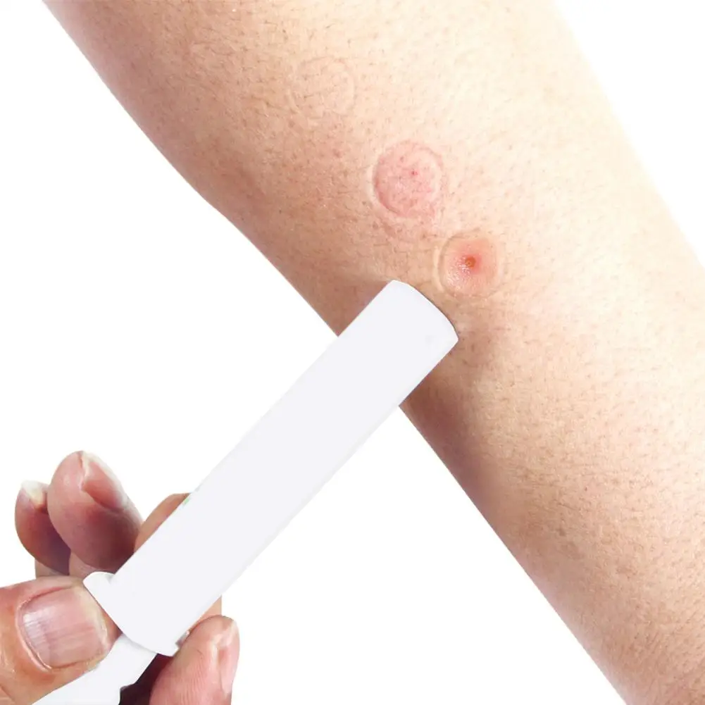 Насос для удаления ядов комплект выживания оборудование оказания первой помощи