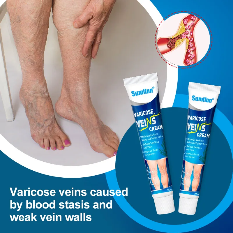 

Treatment for Varicose Veins Chinese Herbal Medicine for Varicosity Angiitis Removal Phlebitis Legs Veins Ointment Body Care