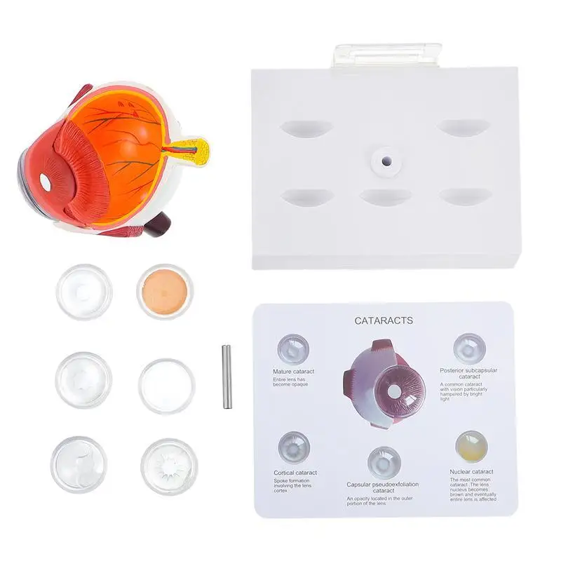 Демонстрационный набор для демонстрации болезни глаз от роговицы | Канцтовары