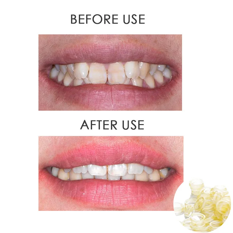 10 г/50 г твердый клей FalseTeeth набор для временного ремонта зубов Falseteeth