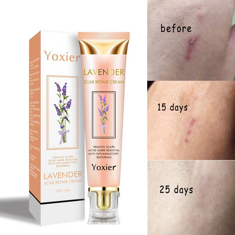 1 шт. 20 г восстанавливающий крем для шрамов Удаление прыщей растяжек корректор