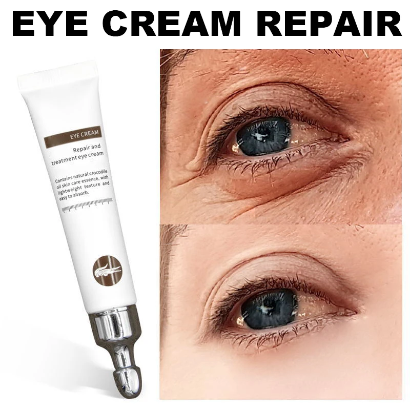 

Magic Anti-age Eye Cream Eye Serum Reduce Dark Circles Puffiness Under Eye Bags Wrinkles MA