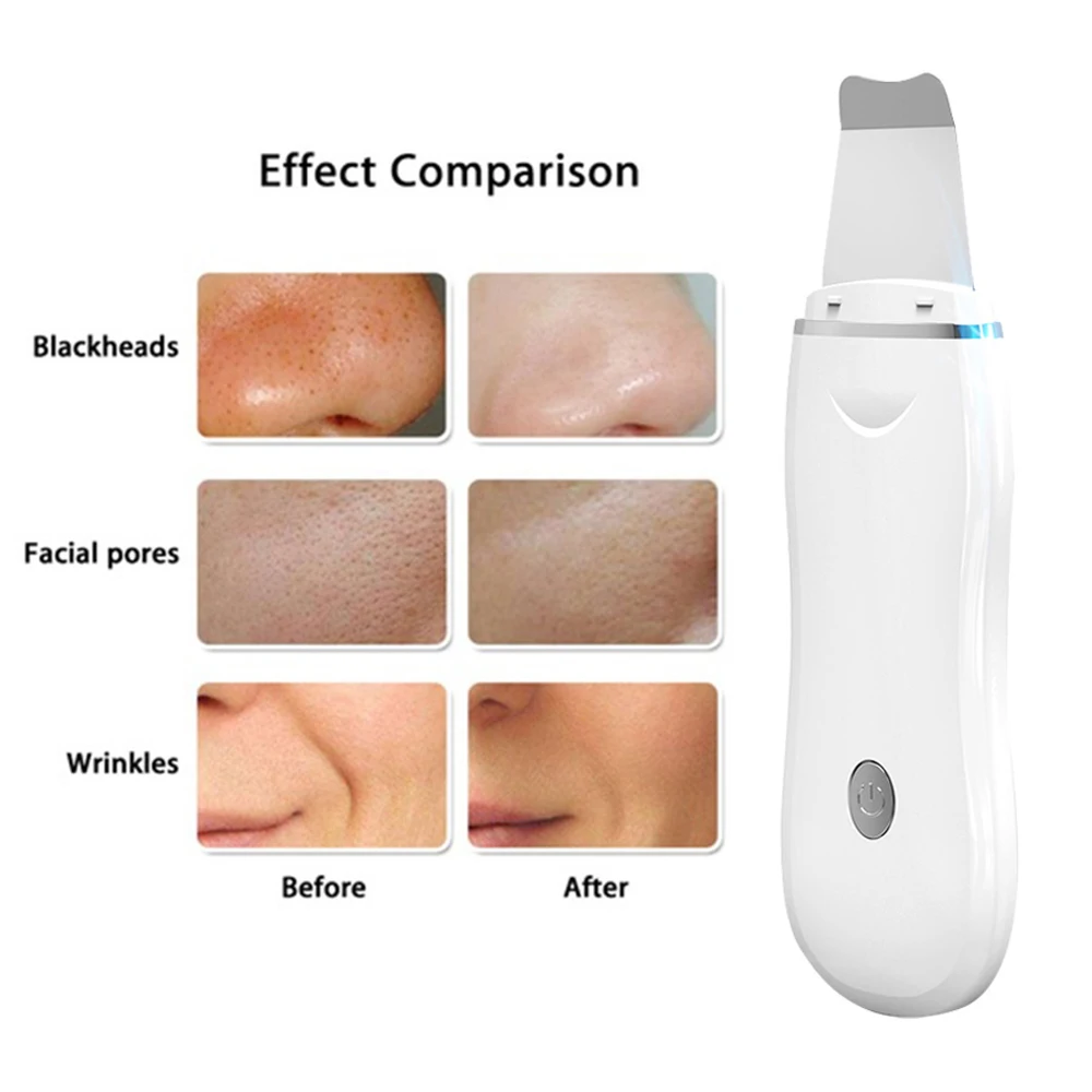

Ultrasonic Skin Scrubber Facial Pore Cleaner Moisturizing Facial Steamer Extractor Blackhead Removal Deep Clean Skin Care Tool