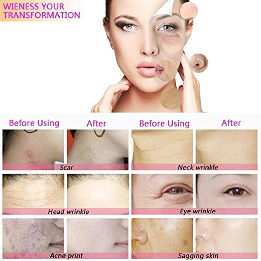 3 в 1 Алмазная Микродермабразия дермабразия машина спрей для воды отшелушивающая