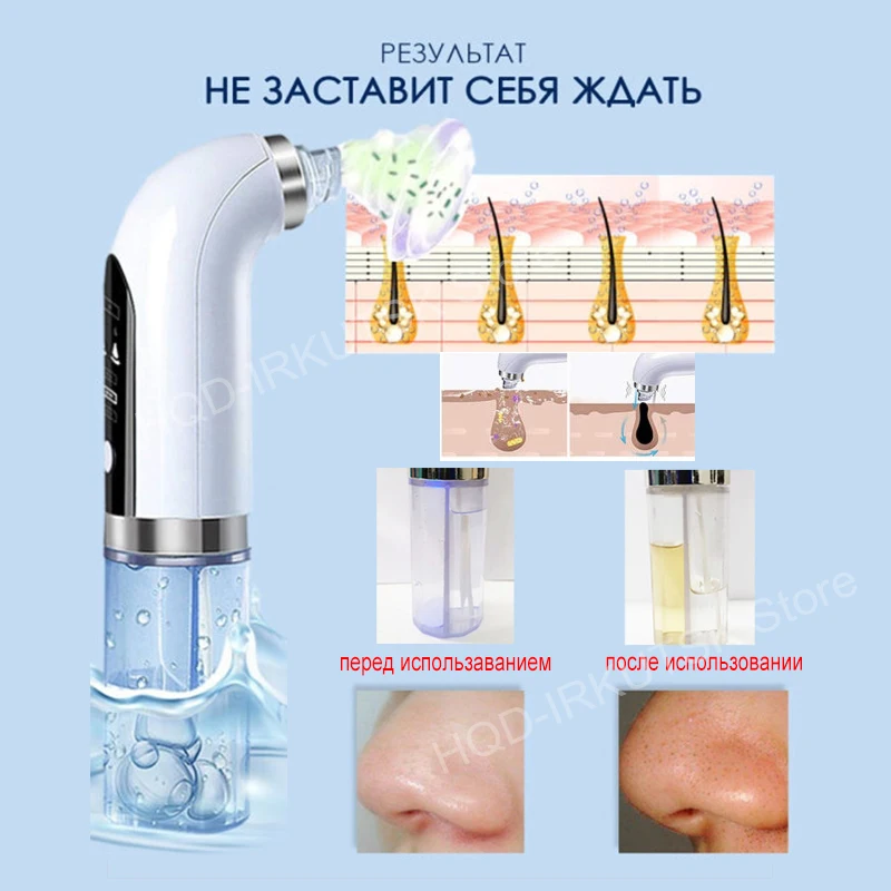массажер для лица вакуумный очистить пор Пилинг Средства от черных точек и прыщ