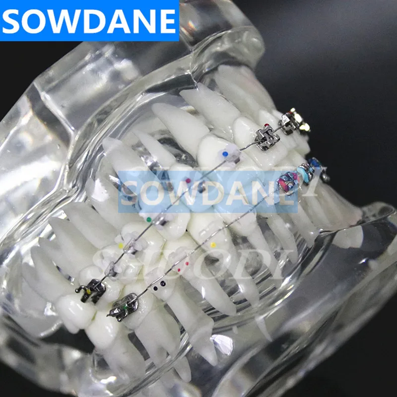 Стоматологическая Ортодонтическая модель 4 вида кронштейнов с керамическим