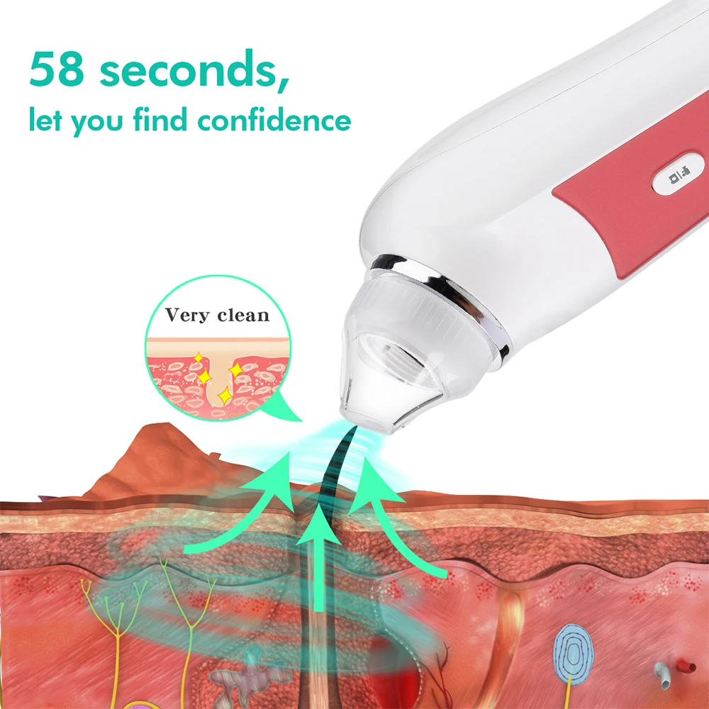 

Wifi HD Visible Nose Facial Blackhead Remover Acne Pore Cleaner Pimple Blackdots Removal Tools Blackhead Vacuum Suction with Box