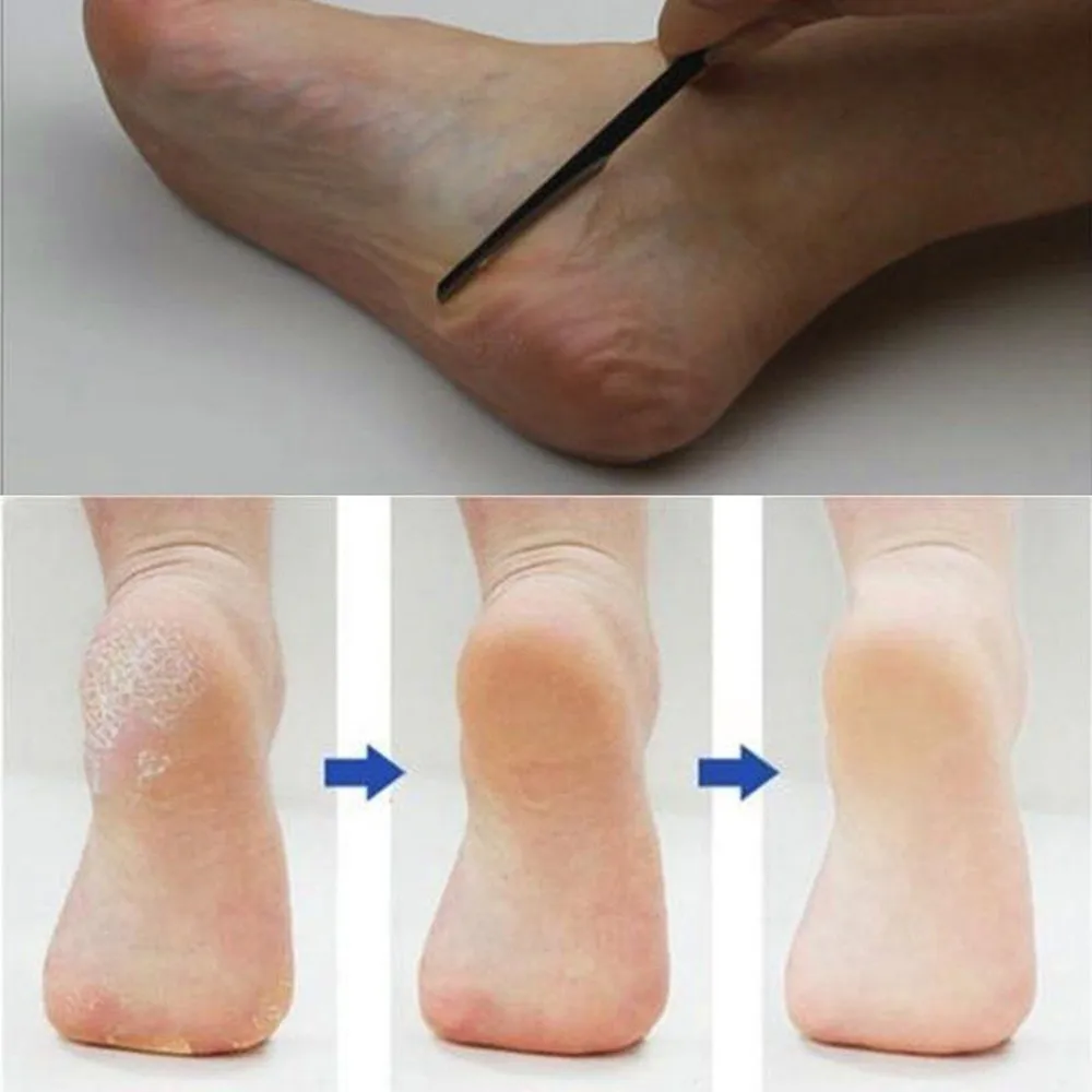 2019 New Fashion Pedicure Manicure Nail Cleaner Cuticle Grooming Dead Skin Planer Beauty Foot Care Tool Drop Shipping | Красота и