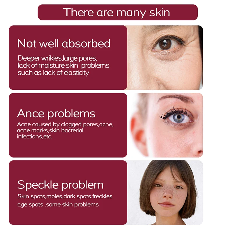 Кожа иглы прожектор освещение безболезненное лечение удаление крот веснушки