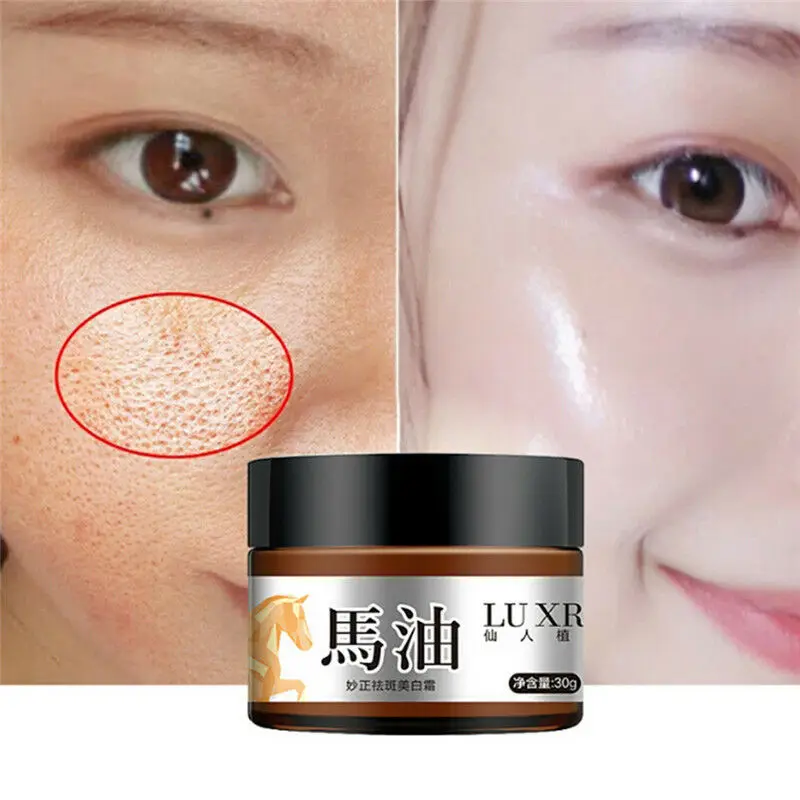

Skin Brightening Cream Freckle Cream For Face Melasma Treatment Skin Care 30g