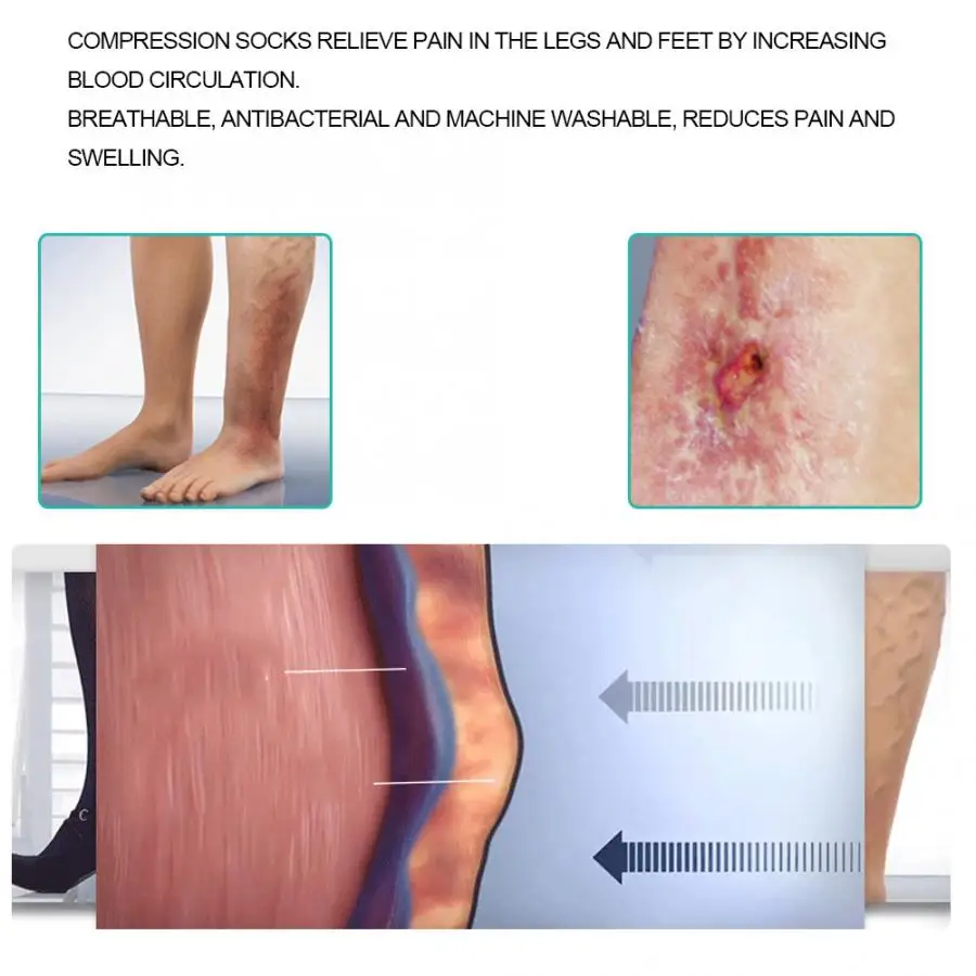 Компрессионные чулки эластичные для похудения|Товары похудения| |