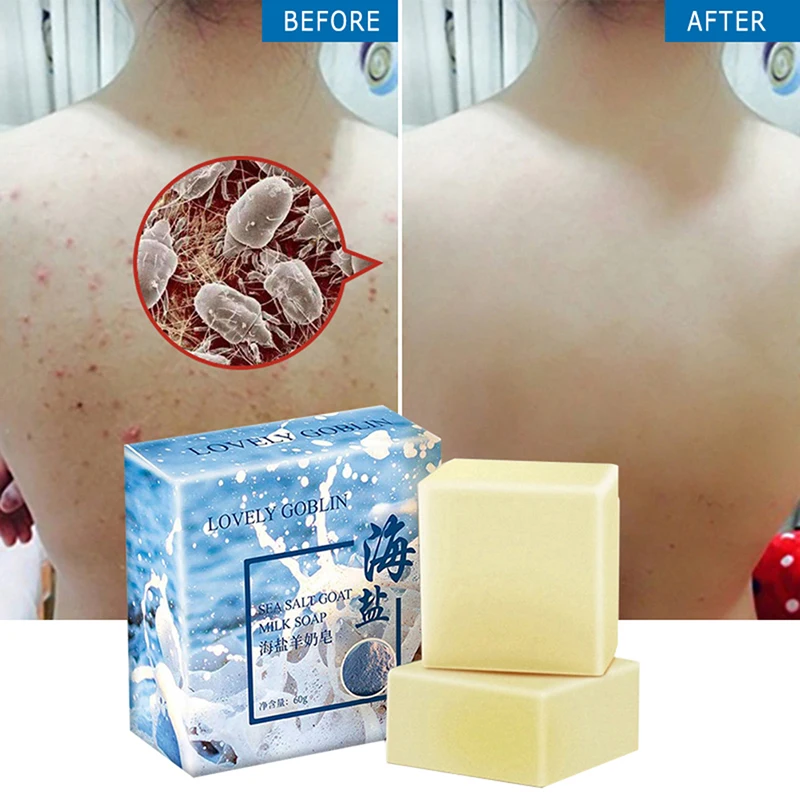 

60g Removal Pimple Pore Acne Treatment Sea Salt Soap Cleaner Moisturizing Goat Milk Soap Face Care Wash Basis Soap