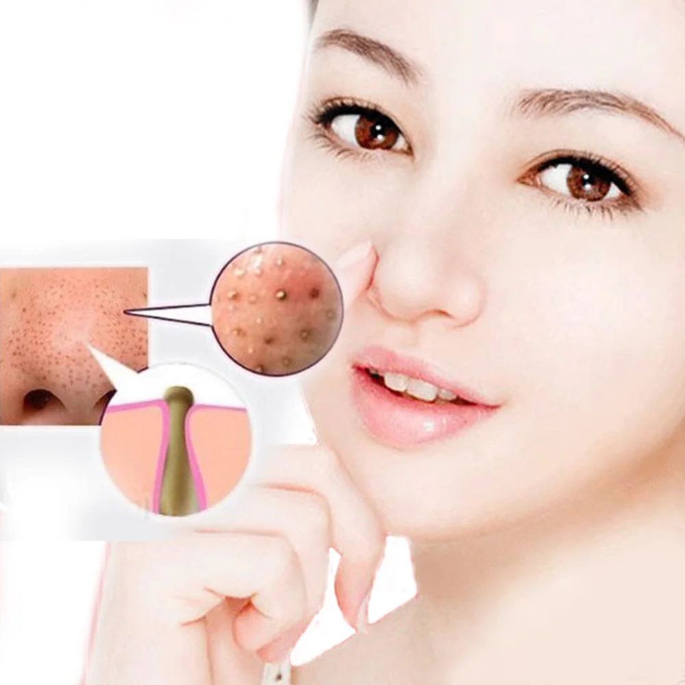 Blackhead удаление Глубокая чистка шелушиться голова поры маска для лица угрей 50 шт в