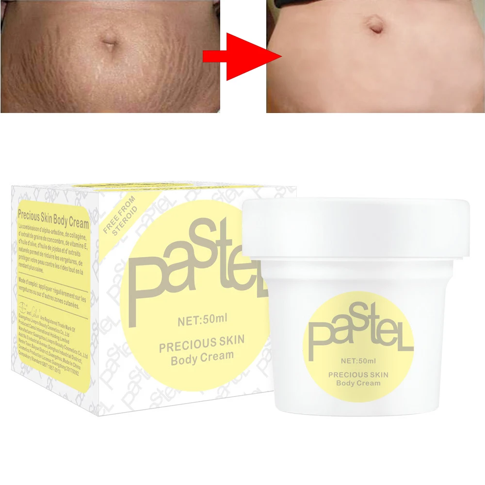 Крем от растяжек с новым рисунком Для Удаления лечение жирными шрамами и