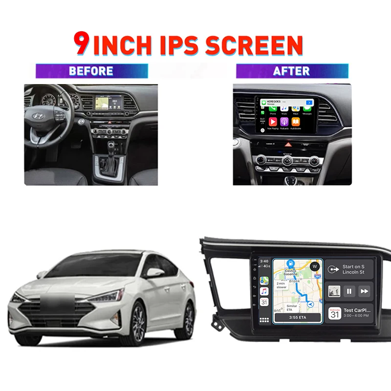 Автомагнитола с камерой 360 Android 11 0 мультимедийный плеер для Hyundai Elantra 6 2015 2016 2017 2018