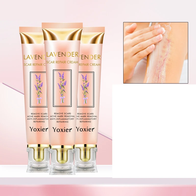 3pcs Yoxier Repair Scar Cream Acne Scar Stretch Marks Pigmentation Corrector Anti-allergic Calm Whitening Skin Care Face Cream