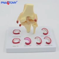 life size knee joint model with ligaments shows meniscus tears medical teaching tool anatomical model skeleton anatomy