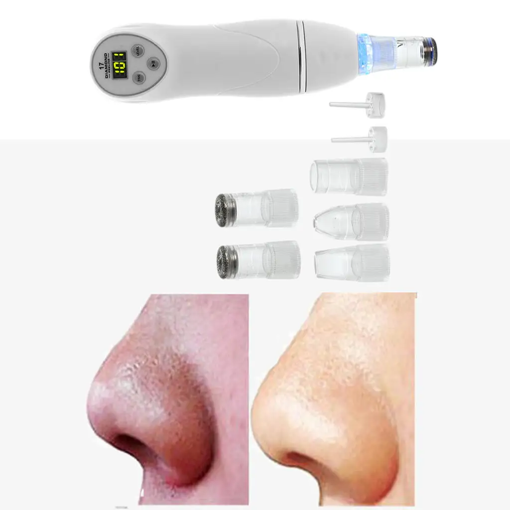 Средство для удаления черных точек Инструмент извлечения комедонов Бытовая