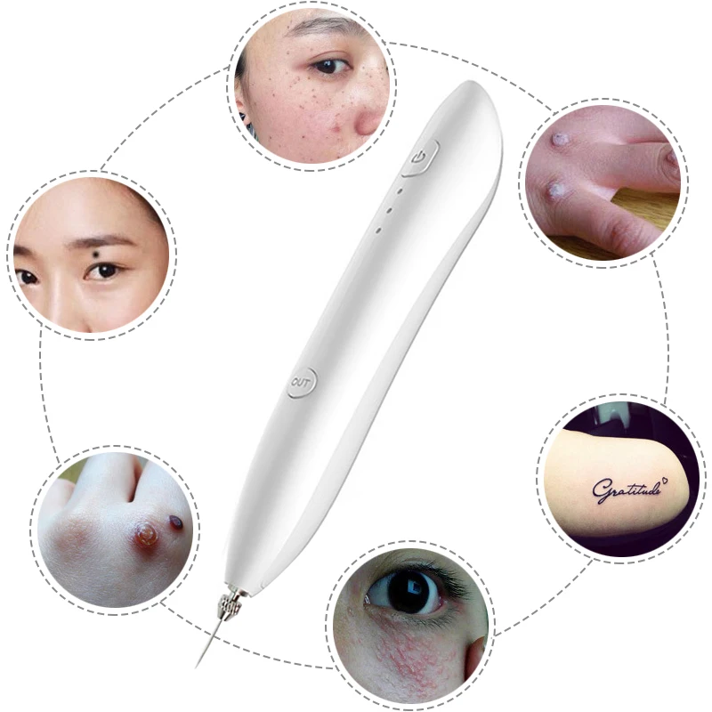 Лазерный прибор для удаления родинок плазменной ручка темно пятновыводитель