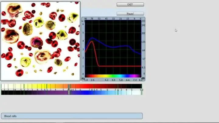

Original automatic 18d blood chemistry analyzer bioplasm V7 nls health analyzer with CE