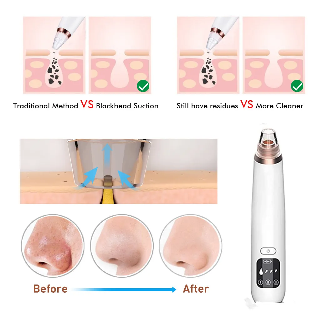 Удаление угрей вакуумный горячий компресс очиститель пор Электрический Нос лицо