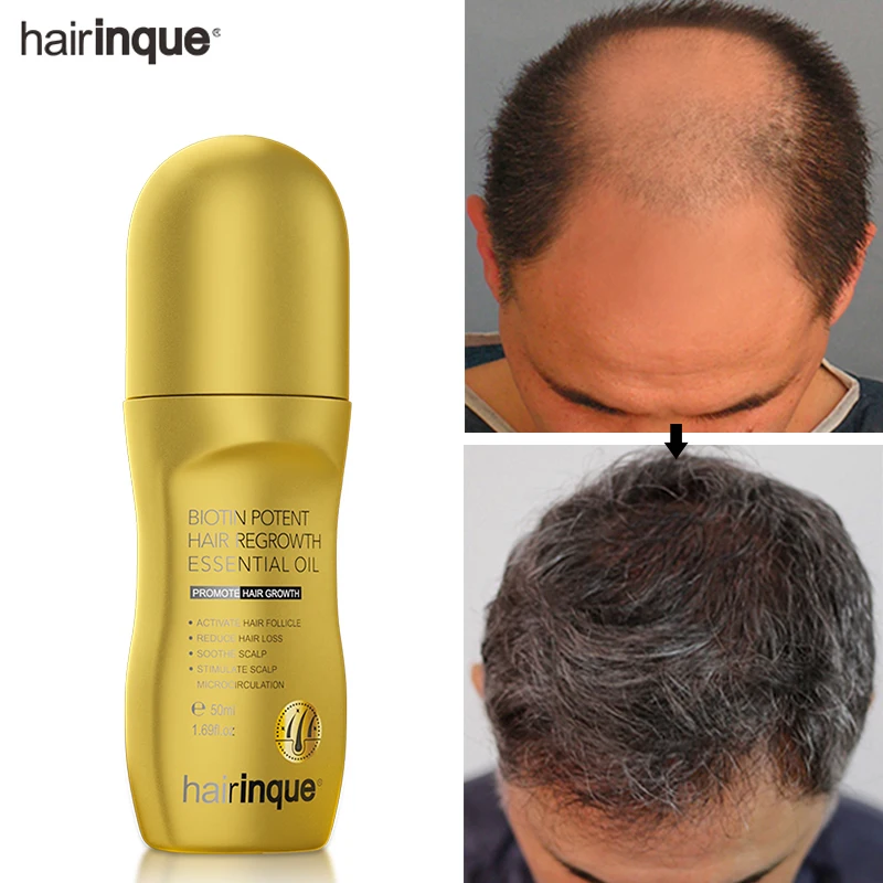 Hairinque Vitamin B7 Hair Growth Oil Prevent Hair Loss Serum Scalp Treatments Fast Growing Hair Care Products for Men Women 50ml