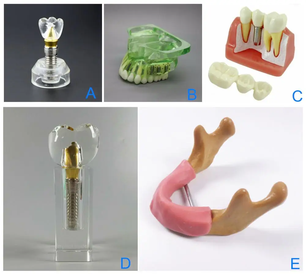 1 шт. стоматологическая обучающая модель имплантата| |