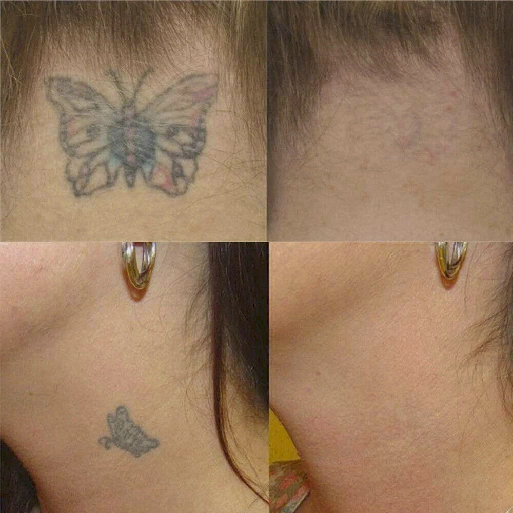 Паста для очистки татуировок натуральный безболезненный крем удаления