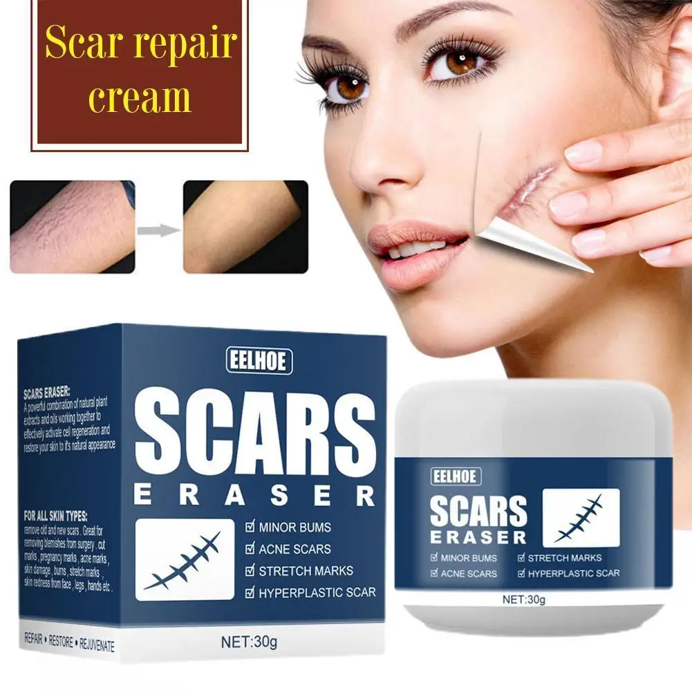 

30g Scar cold compress gel Scar Removal Cream Acne Burn A Scars Surgical Corrector Stretch Marks Gel For Body Scar Pigmenta A0F4