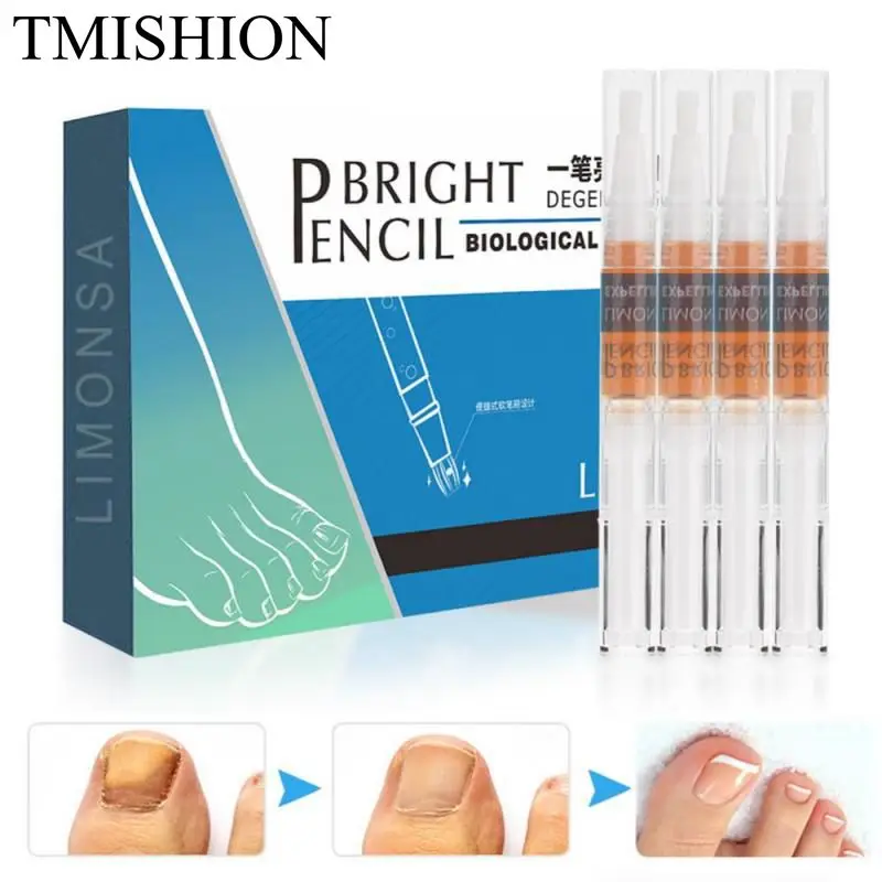 TMISHION 4 шт. средство для лечения грибка ногтей защита ног инструменты ухода за