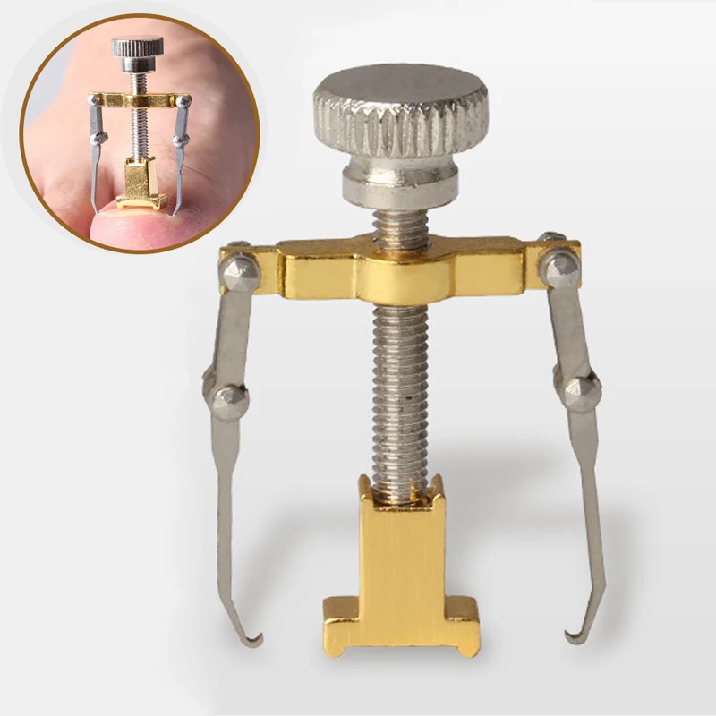 1 шт. вросший носок для коррекции ногтей Педикюр фиксатор выпрямитель клипперы