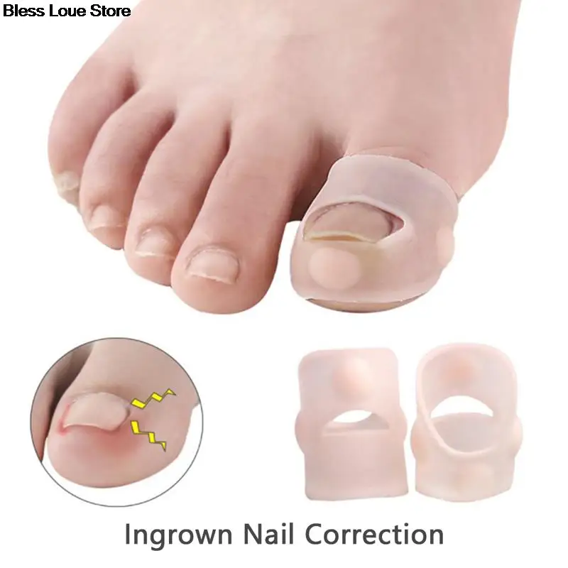 

Телесный мягкий силиконовый инструмент для коррекции вросших ногтей Невидимый лечебный эластичный зажим для выпрямления ногтей 1 шт.