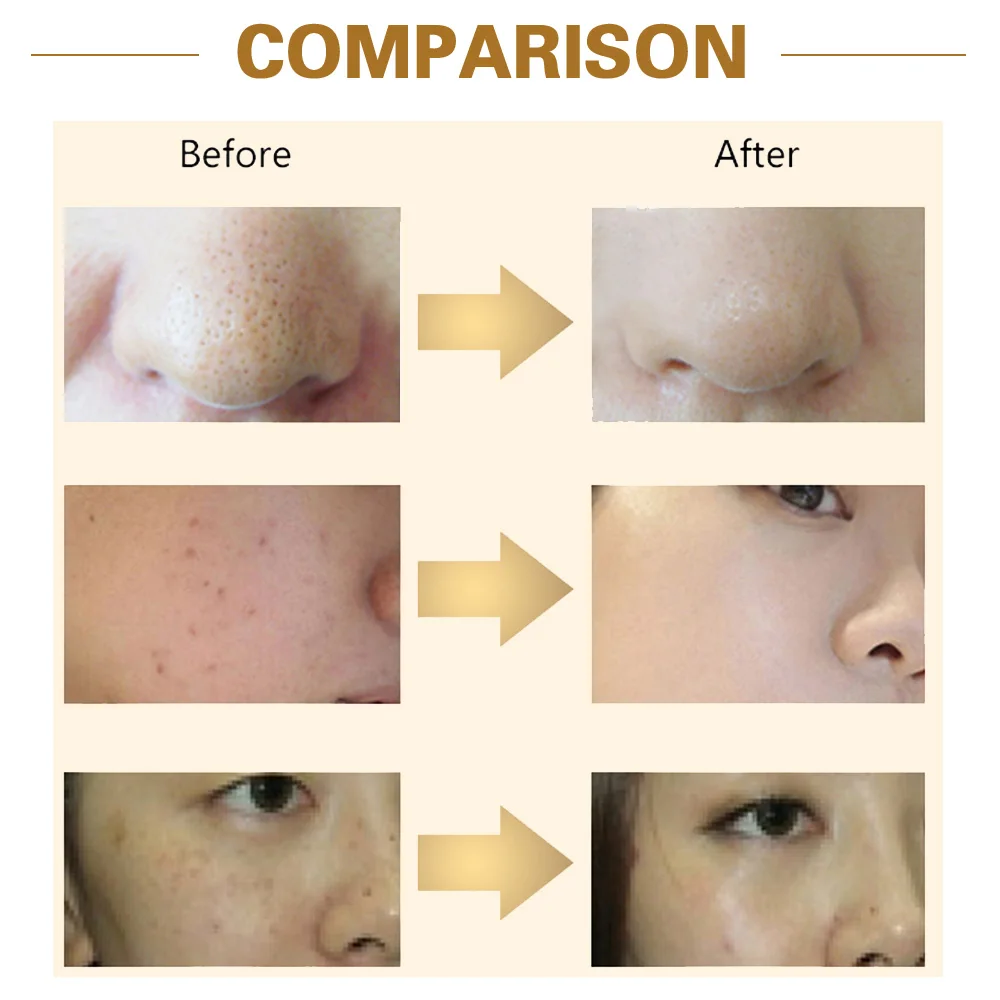 7 цветов светодиодный маска для лица красота омоложение кожи Фотон светильник