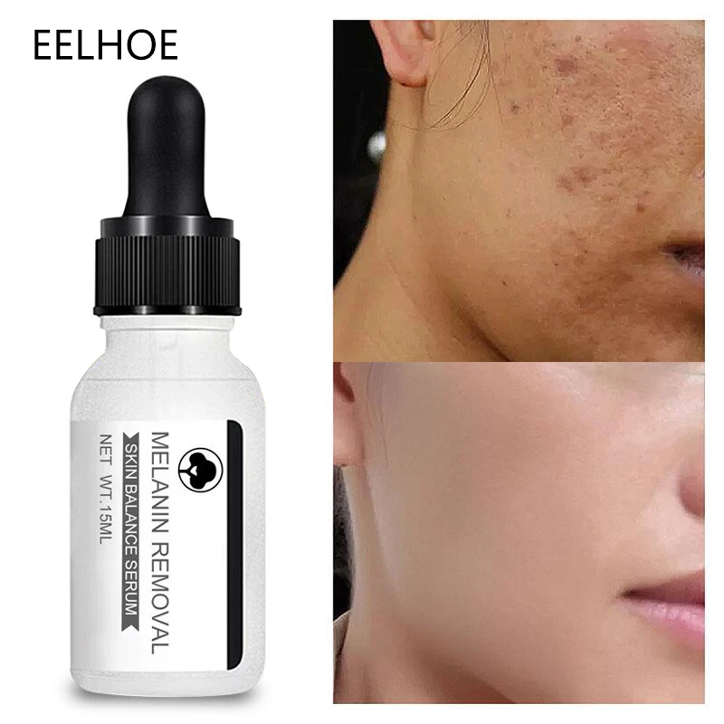 

Whitening Remove Freckle Face Serum Fade Dark Spots Melasma Melanin Facial Essence Brighten Moisturizer Acne Treatment Skin Care